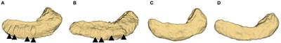 Fine scale hippocampus morphology variation cross 552 healthy subjects from age 20 to 80